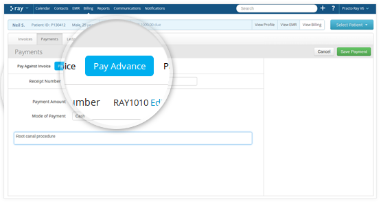 advance payments